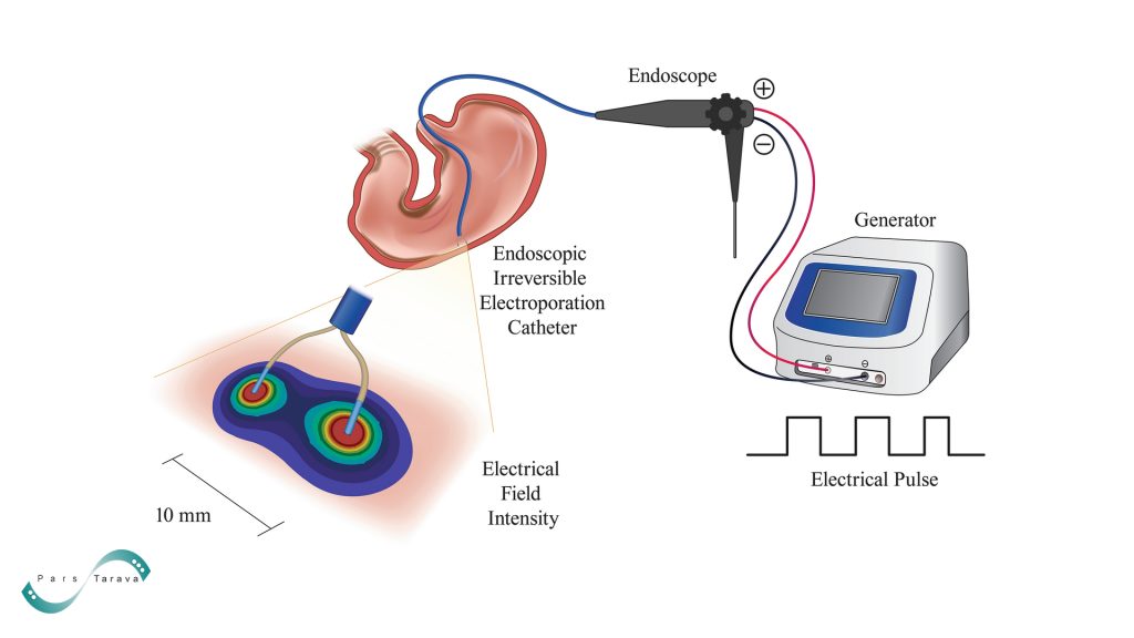 clinical application of Irreversible Electroporation