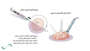 فرآیند درمان الکتروکموتراپی در انسان و درمان حیوانات