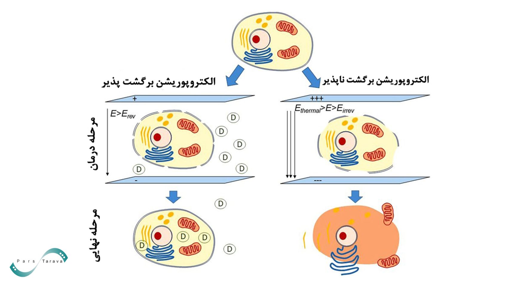 تفاوت الکتروپوریشن برگشت ناپذیر (IRE) و الکتروپوریشن برگشت پذیر
