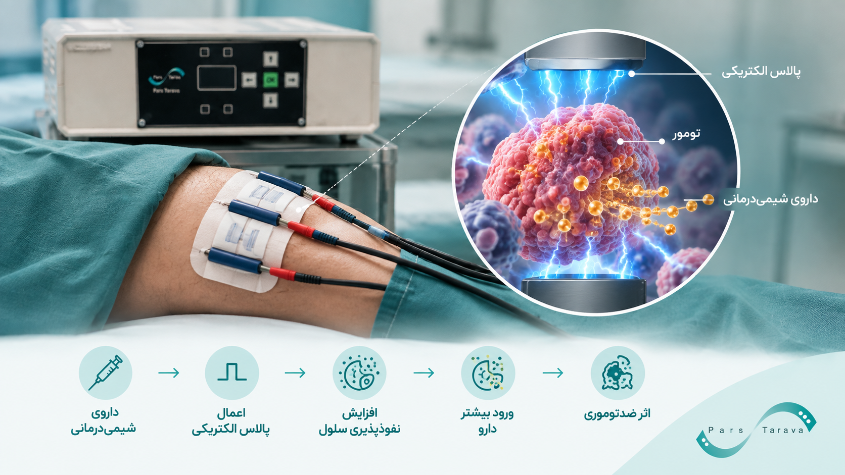 الکتروکموتراپی چیست